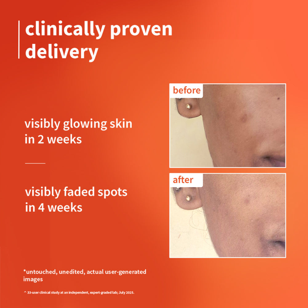 Plum 1% Vitamin C Ultra-Light-Glow Boosting Gel Cream with Alpha Arbutin | Boosts Glow | Fades Dark Spots & Pigmentation | Deeply Hydrates, 50g Buy at Indicrest Image 2