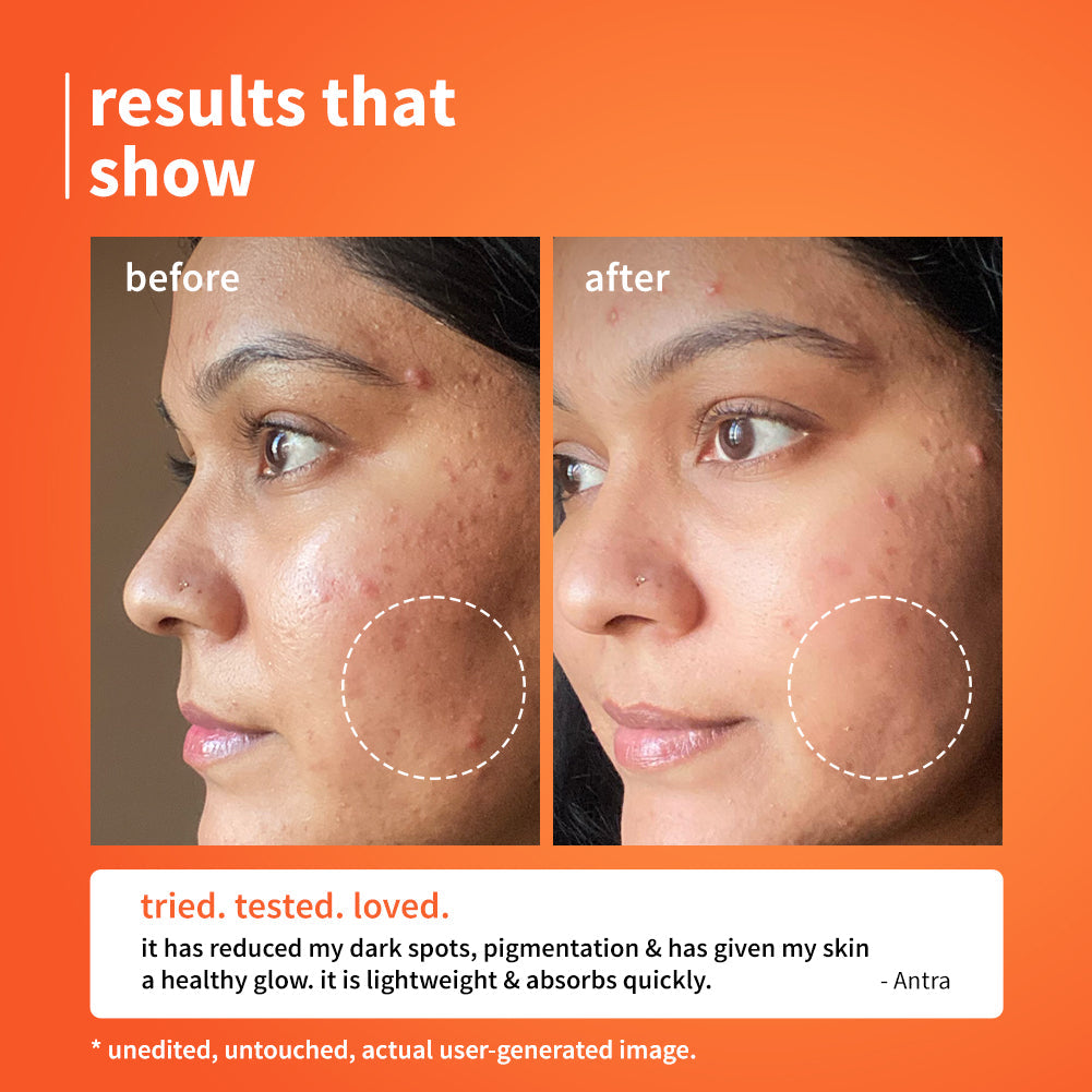 Plum 10% Vitamin C Barrier Boosting + Glow Serum with Calendula | Boosts Glow From 1st Use | Fades Dark Spots In 14 Days | Dermat-Tested, 30ml x 2 Buy at Indicrest Image 5