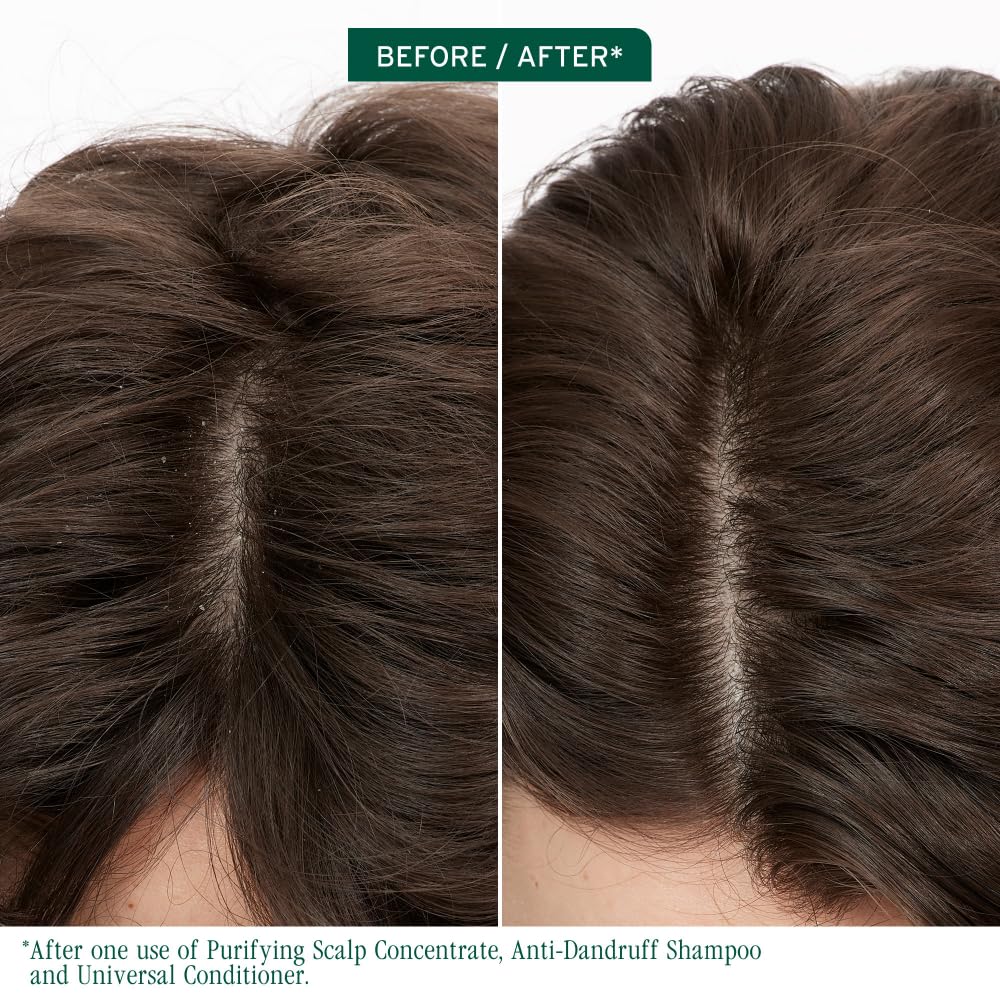 Matrix Biolage Scalp Sync Purifying Concentrate, 200ml Buy at Indicrest Image 7