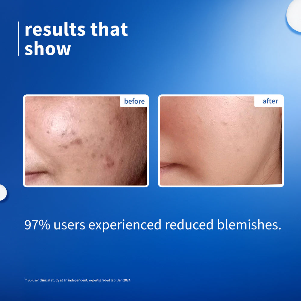 Plum 10% Niacinamide & Rice Water Brightening Face Serum | Brightens From 1st Use | 2X Instant Hydration | Dermat-Tested, 50ml Buy at Indicrest Image 4