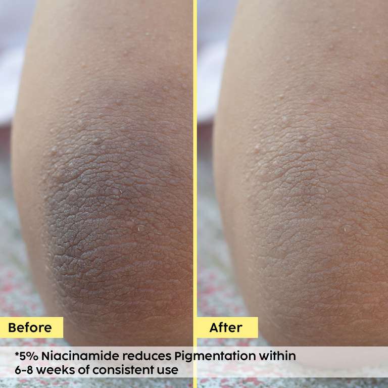 Plix Pineapple Bright Polishing Cream for Dark Underarms & Even-Toned Skin, 50g Buy at Indicrest Image 3