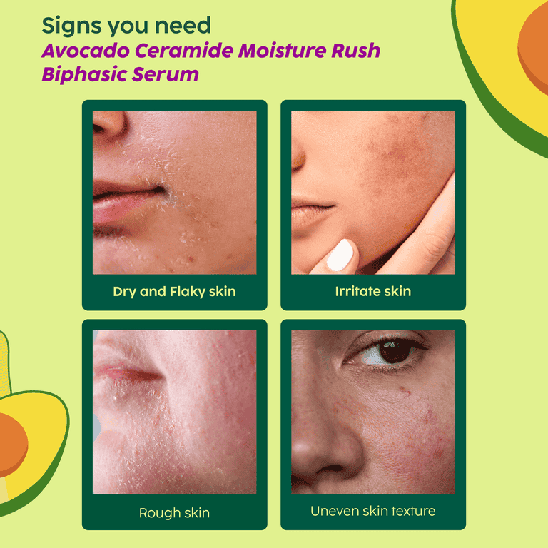 Plix Avocado Ceramide Moisture Rush Biphasic Serum for Strengthening Moisture Barrier, 30ml Buy at Indicrest Image 3