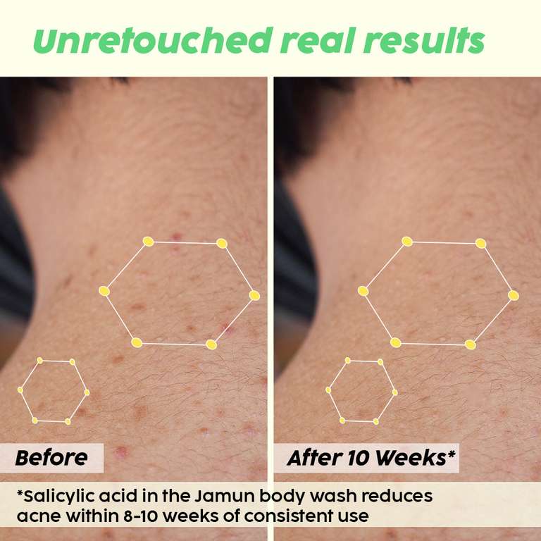 Plix Jamun 2% Salicylic Acid Body Wash For Body Acne, Bumpy Skin, 236ml | For All Skin Types Buy at Indicrest Image 2